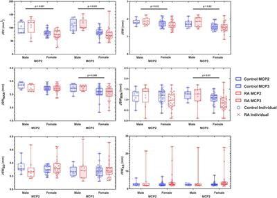 Evaluating high-resolution computed tomography derived 3-D joint space metrics of the metacarpophalangeal joints between rheumatoid arthritis and age- and sex-matched control participants